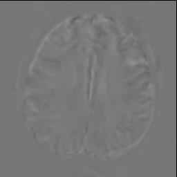 Moreover, the fact that the subject s head cannot remain still during a long imaging scan makes dynamic image series suffer from bulk motion.