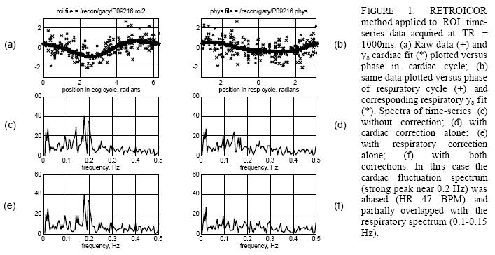 Physiological noise: Examples Cardiac noise Data Analysis: Data-Driven Functional Connectivity
