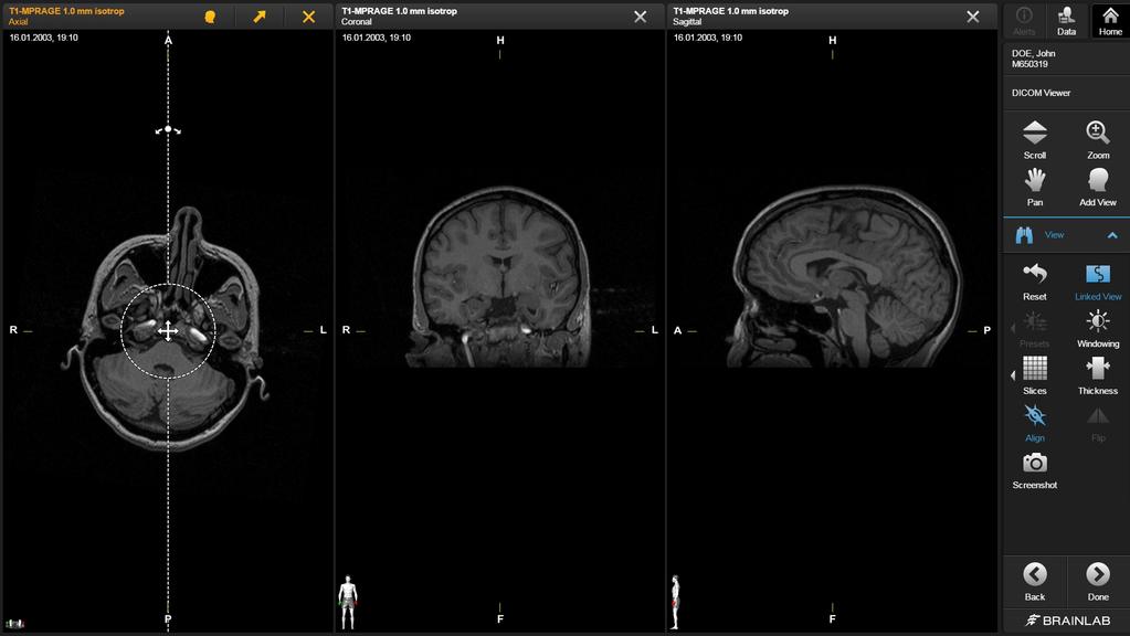 DICOM VIEWER Options To minimize an image, press the minimize arrow. To change the image in the maximized view 2, press an image in the image list 1 or drag an image onto the maximized view to swap.