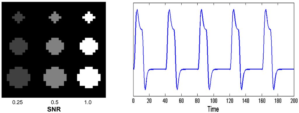 the term expγ jk ), which represents the adaptive variance of the voxel located at the location [u j,v k ].