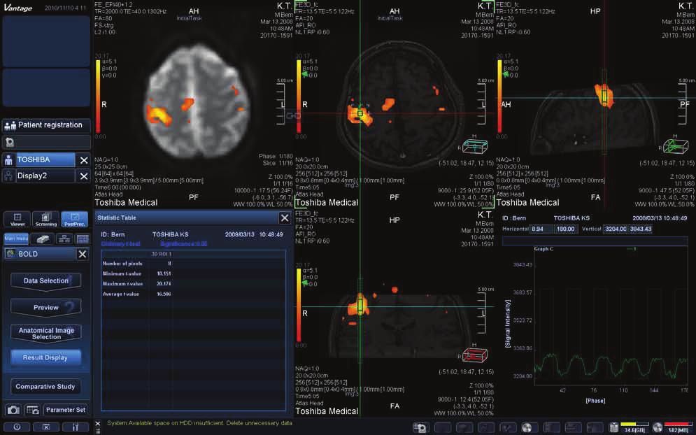fmri post-processing with M-Power uses original T-value scoring which is the gold standard for measuring blood oxygen levels. STEP 1 Load the fmri data set by selecting one image from the sequence.