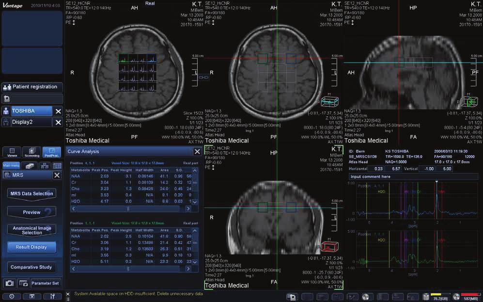 fmri, Spectroscopy, Diffusion Tensor Imaging and Diffusion Tractography applications can be accessed on the main console using the following simple, threestep process.