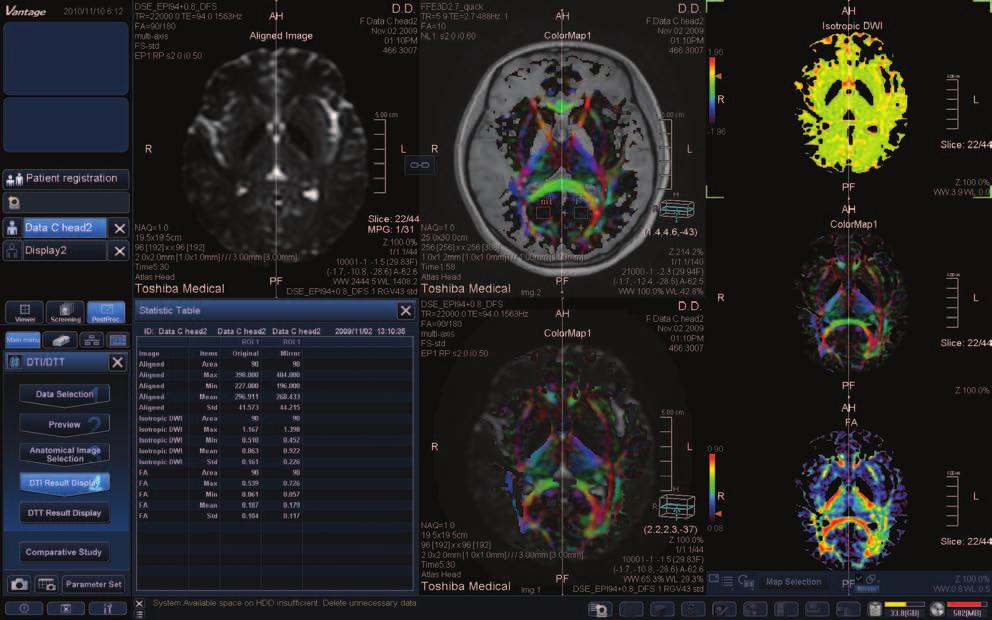 Review and save in a DICOM format the results for Diffusion Tensor Imaging. Review and save in a DICOM format the results for Diffusion Tensor Tractography.