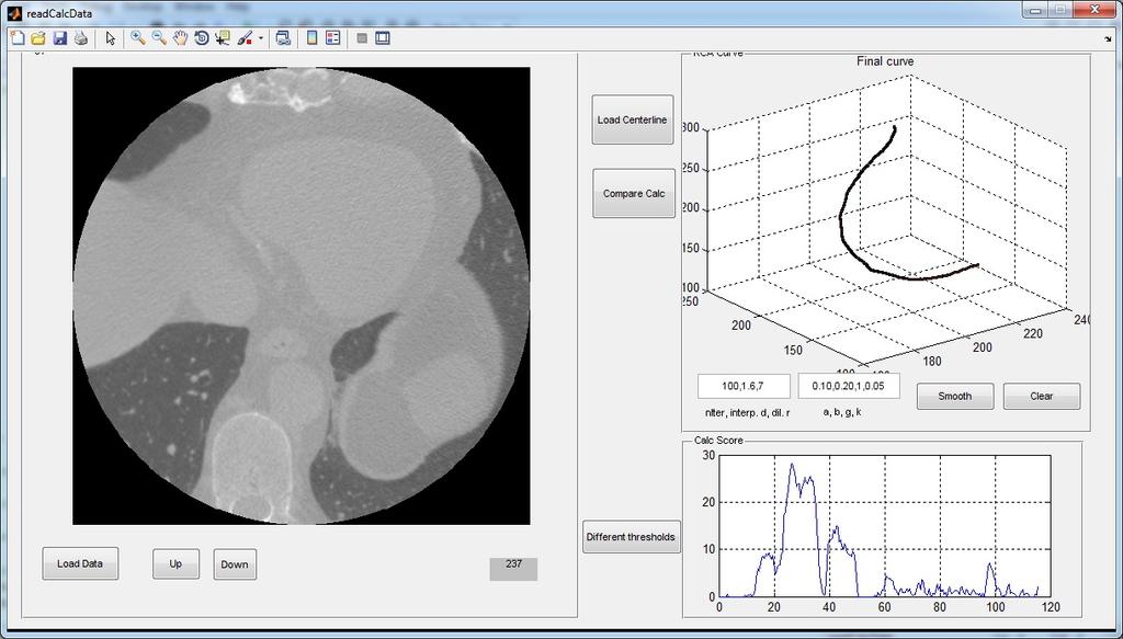 26 Figure 3.1 Software tool to browse through the CT slices and annotate the desired artery to extract the centerline. the image features at each step.