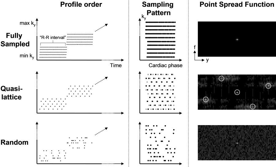 88 Hansen et al. FIG.. Sampling strategies for retrospectively gated Cartesian imaging. The first row shows the typical sampling strategy for a full acquisition.
