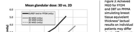 45 mgy = dose GE DBT Uses a grid in 3D Reduces scatter Preserves dose & performance