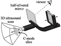 the mirror. The monitor is mounted in a track to permit selection of the appropriate depth for any C-mode slice within the 3D ultrasound scan. Fig 5.