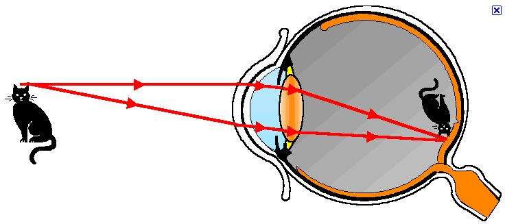 The Eye Light passes through lens (adjustable ocal length) Focused, real image ormed on retina Myopic (near-sighted): image orms in ront o retina (concave lenses)