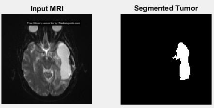 188 IV. PROPOSED ALGORITHM Objective: To perform segmentation of Brain Tumor region. Input: MRI scan image. Expected Output: Segmented Brain Tumor region.