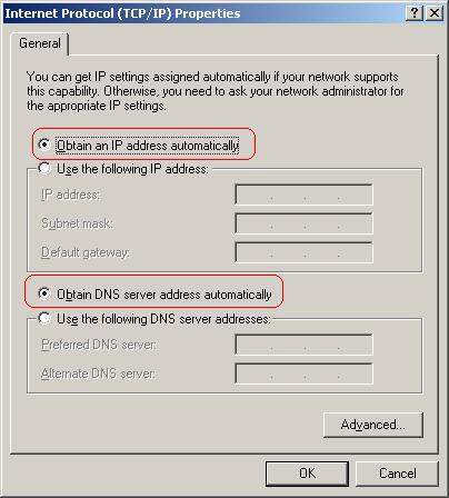 Obtain an IP address automatically and Obtain DNS server