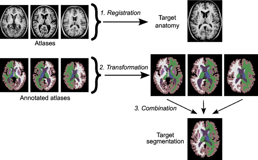 Figure 3: An example of multi-atlas segmentation of brain MR images. MOTION CORRECTION There are a number of different imaging modalities available to medical community.
