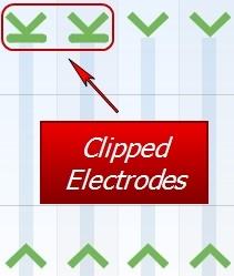 How To The electrode(s) will display clipping markers, indicating that clipping has been enabled.