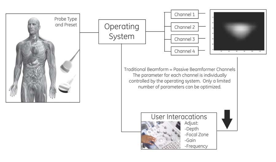 Figure 7: Diagram of a Conventional Ultrasound System Design Every time the user changes a system operating parameter such as depth, focal zone position, or imaging frequency, the operating system