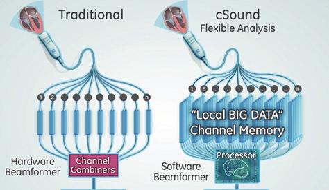 The csound architecture has been designed from ground up to address some of the fundamental limitations of today s ultrasound systems, aiming to make imaging less patient body habitus dependent.
