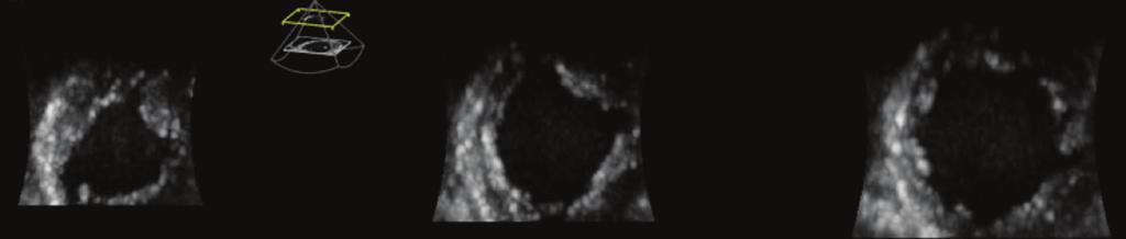 Figure 7: GE Cardiovascular Ultrasound s History of Quantification Raw data format Historically the Vingmed scanners and the GE Vivid product line introduction prior to the year 2000, have always