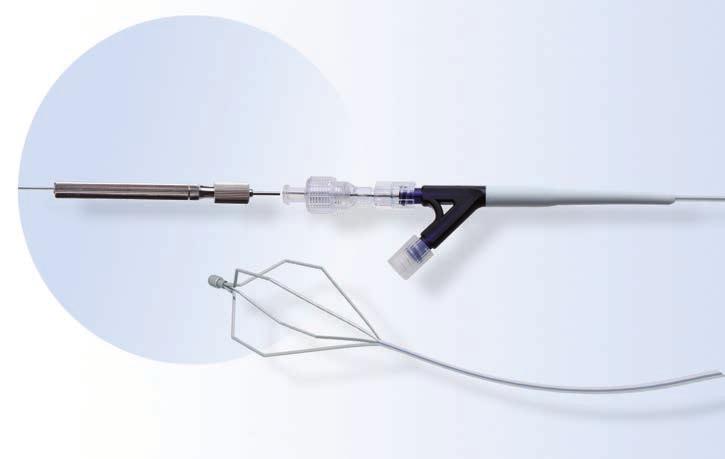 The unique StoneBuster Handle is user friendly and is capable of providing sufficiently high tensions to the surface of a biliary stone via the metal spiral and lithotripsy basket components of the