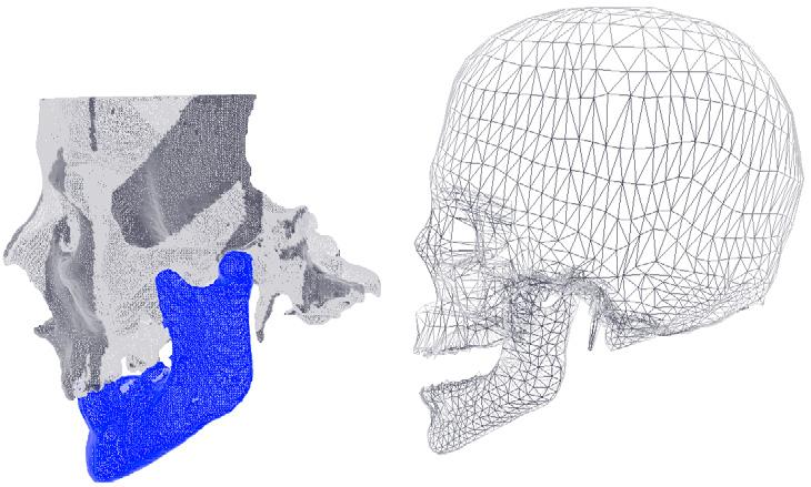 3D Meshes Registration: Application to Statistical Skull Model 101 2 Method The literature treating registration methods is very extensive (e.g., [5] for a survey).