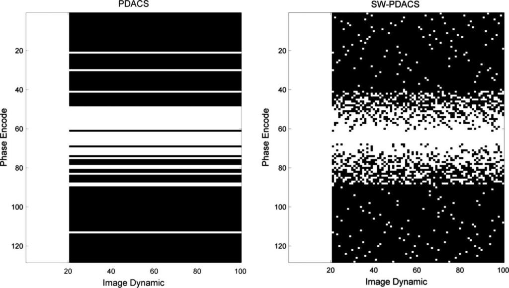 87 Yip et al.: Sliding Window PDACS for Tumor Tracking 87 imaging sequence prior to tumor tracking.
