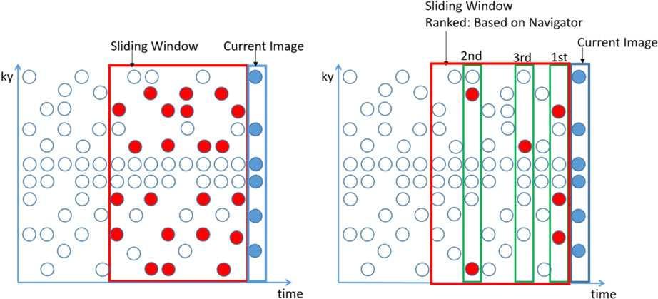 89 Yip et al.: Sliding Window PDACS for Tumor Tracking 89 FIG. 3. Left sliding window averaging method, each circle represents a k-space line.