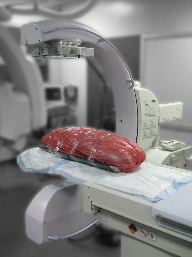 June 5, Cadaver Abdomen Realistic Soft Tissue Imaging Fresh