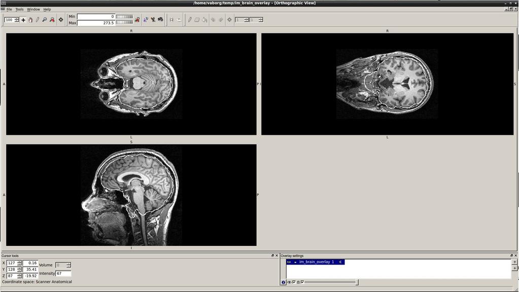 Math in image processing: segmentation FSL: BET Fslview