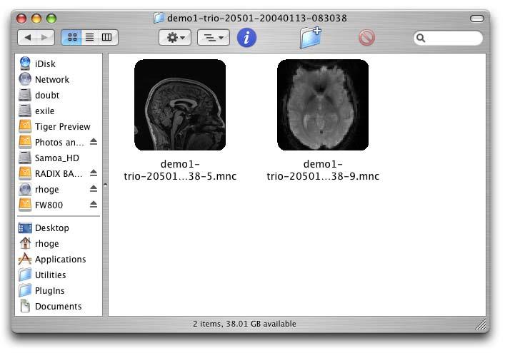 While NeuroLens can load DICOM files very quickly, it will generally be more convenient to export the scans to a format in which there are fewer files.