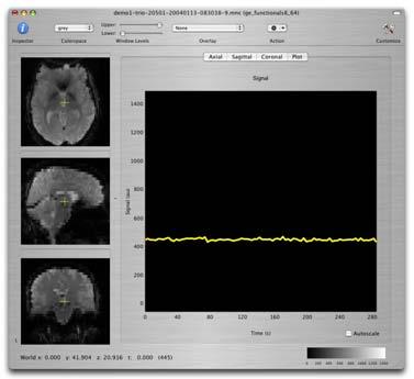 You can select large image views for series 9 using the tabs at the top of the window labeled Axial, Sagittal, and Coronal and conversely for series 5 you can view plots of spatial intensity profile