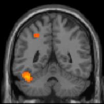 Canonical brain? Overlay on group average EPI?