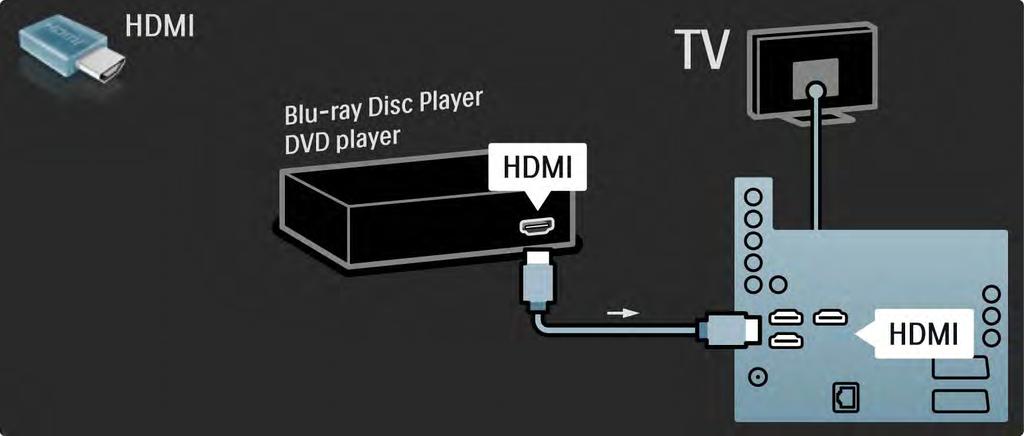 5.3.1 Blu-ray-plaadimängija / DVD-mängija Kasutage Blu-ray-plaadimängija või