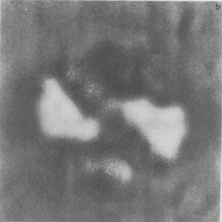 C-scan image of the impact damage at the third ply