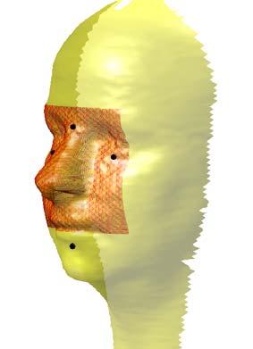 For some of the subects there are large voids in the facial surface grids. Figure 5, shows the facial surface and the new rectangular grid.