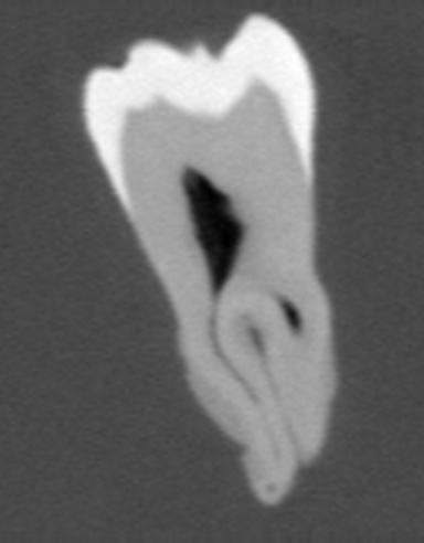 α Transfer Function(2/2) RGB [Kindlmann 2002] f RGB(f) a(f) CT Human Tooth Shading, Compositing Perception-Guided Transfer Function Specification The effectiveness of DVR largely depends on