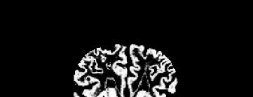 Brain MRI segmentation pipeline :