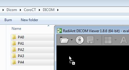 14 RadiAnt DICOM Viewer 5.