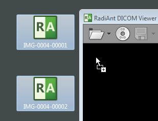 20 RadiAnt DICOM Viewer 5. The process of loading will start.