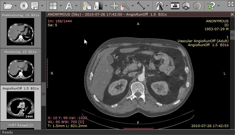 24 RadiAnt DICOM Viewer Browsing images As soon as the images start appearing in the panel you may begin browsing them. There are several different ways of paging through the images of the series: 1.