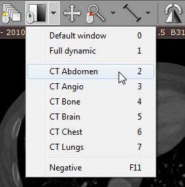 26 RadiAnt DICOM Viewer Window presets Different window presets can be quickly applied by pressing 0 through 9. 0 Default window for the current image.