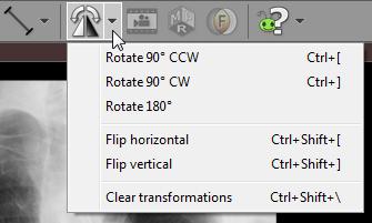 38 RadiAnt DICOM Viewer You can also apply rotations and flips from a drop-down menu.