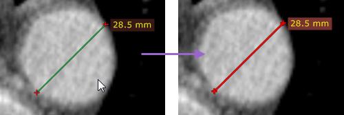 58 3.3 RadiAnt DICOM Viewer ROI operations Select an object