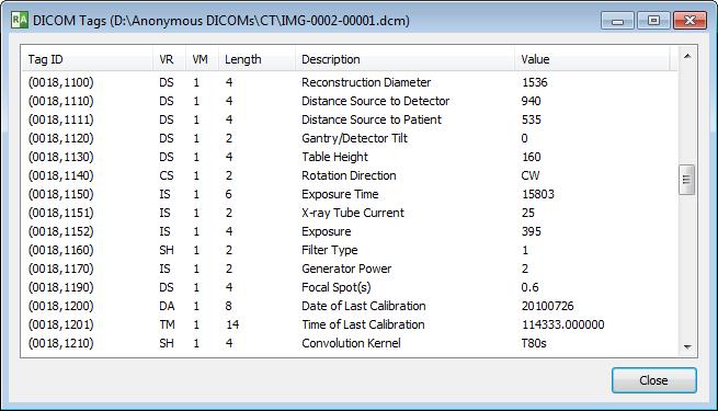 72 3.7 RadiAnt DICOM Viewer DICOM tags Each DICOM file contains much more information than can be displayed as annotations on the image.