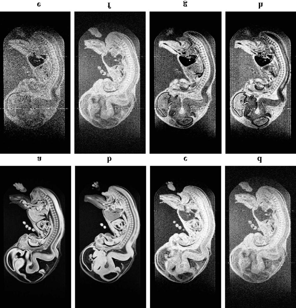 Imaging of a Large Collection of Human Embryo nals were usually accumulated 16 or 24 times.