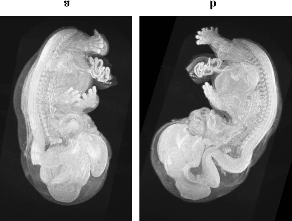 142 Y. Matsuda et al. Fig. 3. Maximum intensity projection images of the CS22 human embryo used to image the crosssections shown in Fig. 2.