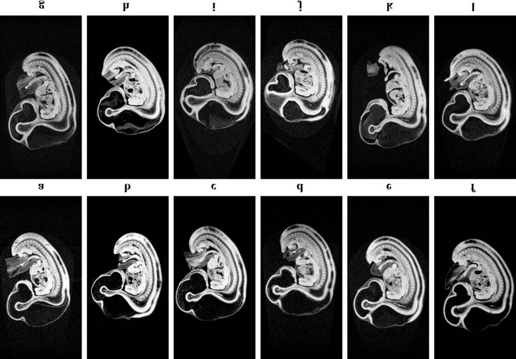 144 Y. Matsuda et al. Fig. 7. Mid-sagittal cross sections selected from 3D image datasets of CS17 embryos acquired with T 1 -weighted spin echo sequences.