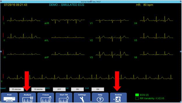 ECG Technician Workflow (non-physician/signer) 1. Click on Analyze button 2.