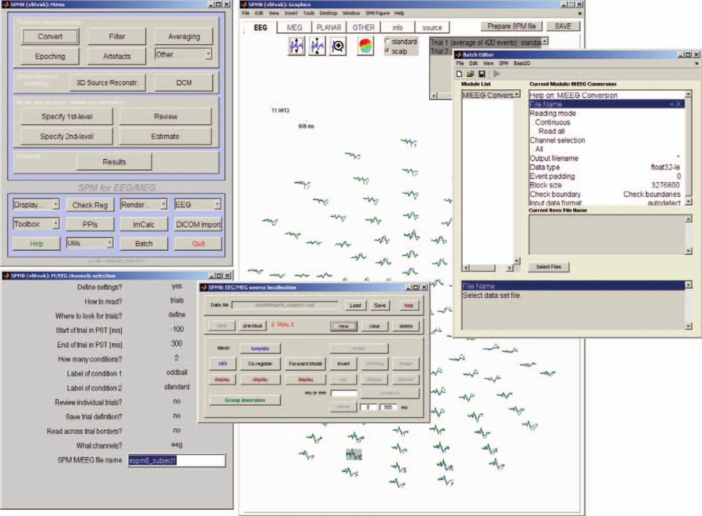 Computational Intelligence and Neuroscience 3 (a) (c) (d) (b) (f) (e) 4 3 2 1 1 2 3 4 5 6 Figure 1: SPM8 for M/EEG graphical user interface tools; see also Figure 11.