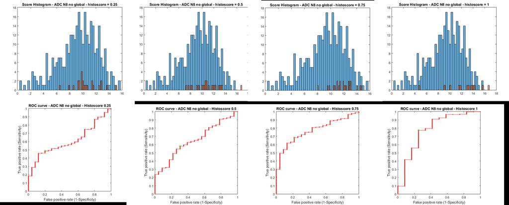 Preliminary Results: PIRADS using PCA Histograms of Score projections of ADC Blue bars =