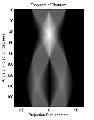 The Radon Transform The principle in parallelbeam tomography: send parallel rays through the object at different angles, measure the damping.