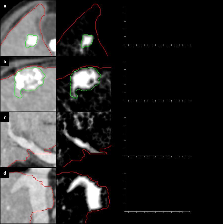3.1 Automated liver lesion detection for contrast-enhanced CT images of the region.