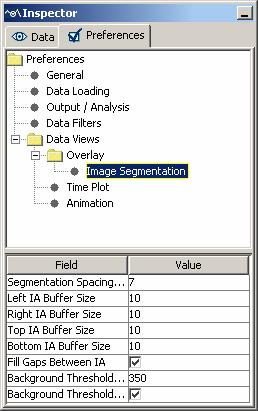 9.7 Image Segmentation Preferences The parameters related to the auto image segmentation preference settings are covered below: Segmentation Spacing Threshold: Number of consecutive pixels below