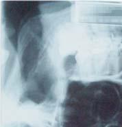 Principle of X-ray imaging The x-ray